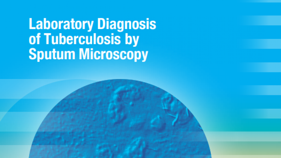 Laboratory Diagnosis of Tuberculosis by Sputum Microscopy The Handbook